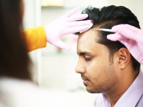 Understanding GFC for Hair Loss in Mumbai_ A Revolutionary Solution for Hair Restoration