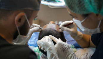 Hair Transplantation