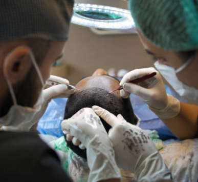 Hair Transplantation