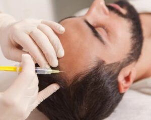 Advanced Hair Transplantation